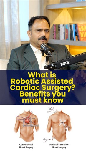 Robotic Assisted Cardiac Surgery Explained | Benefits You Must Know. Robotic Assisted Cardiac Surgery is transforming the way doctors treat heart patients across the world. In this video, we explore what robotic heart surgery is, how it works, and the benefits you must know if you or your loved ones are considering this advanced treatment. Dr. M M Yusuf Senior Consultant (Visiting) – Robotic Cardiac Surgery 📞 To book your slot, please contact: 8111 998 098 #roboticsurgery #cardiacsurgery #robot