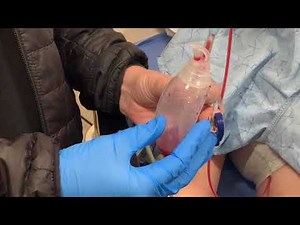 How to Clean Out Your JP Drains