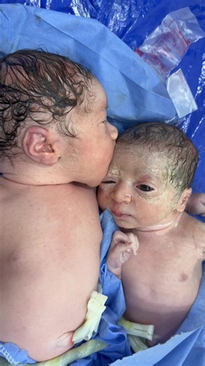 Understanding Moro Reflex in Babies & Islamic Names