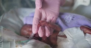 A fragile premature baby gets tender care in the NICU, highlighting the deep bond of hope and support. Providing Compassionate and Diligent Care for Premature Infants in the NICU Unit