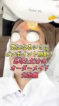 A male clinic director tries the Stella M 22 medical photofacial! Revealing the customized treatm...