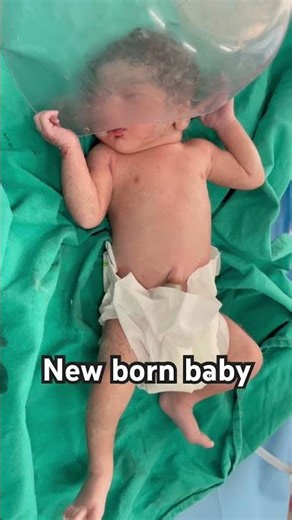 LSCS surgery #subscribe #hospital #doctor #baby #love #newbornbaby