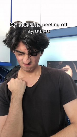 Who else can relate?😂😭 #fyp #trend #comedy #hadee_mk #viral #xyzbca #foryoupage #scabs