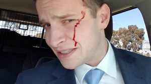 Psycho magpie repeatedly attacks Adelaide cyclist