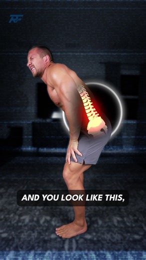 💥 Disc Herniation Exercises! ❌ Have you been diagnosed with a disc herniation? You may notice increased pain with sitting long periods, coughing or sneezing, or that you feel really stiff standing up straight… We meet with around 200 people a week with disc herniations through our online consultations and understand how scary and painful these can be! Many are told these are unrecoverable or need surgery, but this is not true! It doesn’t have to be scary, and we can help you identify the issue 