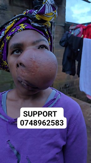 1.4K views · 164 reactions | Save a life today, because every act of kindness writes a new story of hope. 0748962583 | Dr. Joseph Murimi - Save a Life Community | Facebook