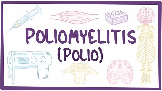 Poliovirus: Video, Causes, & Meaning | Osmosis