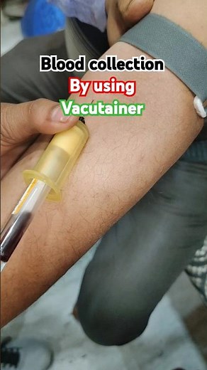 How to blood collection 🩸🩸 by using Vacutainer #bloodcollection #medical #ytshorts #safecarepoint