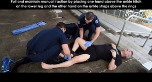 EMS Training: Hare Traction Splint