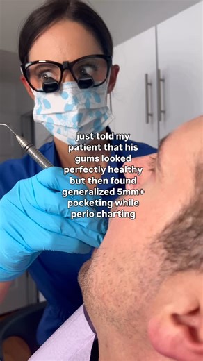 Whitney DiFoggio on Instagram: "Welp. Looks can be deceiving… this is why we ALWAYS chart! Never tell a patient what you ✨think✨ before taking X-rays and doing a full perio exam. A quick glance isn’t enough. Also! Always review medical history! Smoking, for example, can constrict the blood vessels in the gingiva, making the gums look healthier than they actually are 👀🦷 #DentalTruths #PerioCharting #dentalhygienist #dentalhygieneproblems #dentalhygienelife"