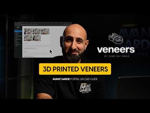 3D Veneers - Avant Garde Portal Tutorial