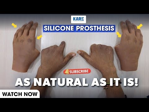 What's The BEST Way to Care for Your Silicone Prosthesis