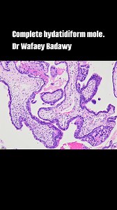 139 reactions · 9 comments | @highlight | Histopathology Histopathology | Facebook