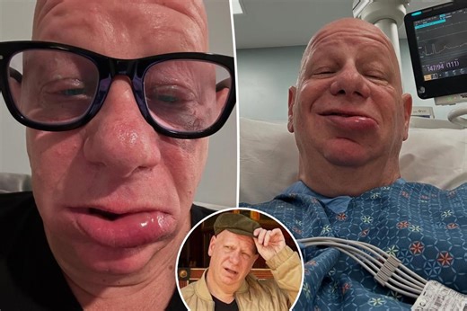 Comedian Jeff Ross ‘spent the night in the ER’ with allergic reaction to ice cream