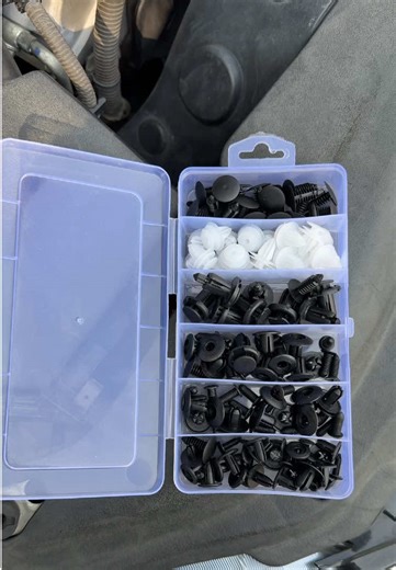 The Engineer's Secret: Why All Cars Use Clips