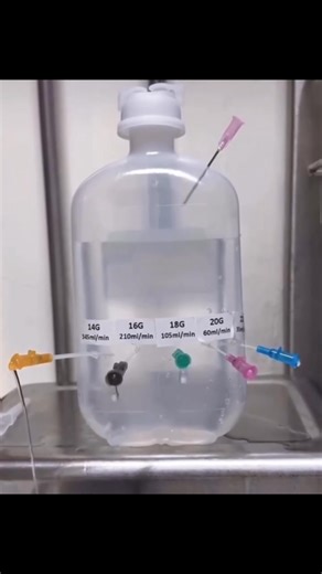 It's not just a needle! 💉 The size of the IV catheter is very important. ​A small catheter can be bad in an emergency. It makes giving fluids take too long. ​A big catheter can be bad for a stable patient. It can cause a blood clot and make the procedure more difficult. ​A nurse must use good judgment to choose the right catheter for each patient. It is not only about putting a needle in. It is about using the right tool for the job. ​#Nurselife #Nurse #NursingStudent #Medical #Healthcare #IV #