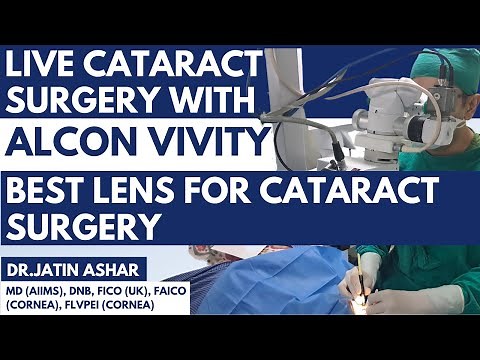 Exploring Alcon Vivity Lens in Live Cataract Surgery | Best Lens for Cataract Surgery