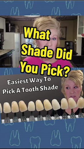 Denture Teeth Shaded #dentures #dentureconfidence #denturestigma #dentures #dentist #denturestigma #dentureconfidence #denturetribe #denturist #dentureeducation #denturesandbeauty #dentureswithmichelle #noteeth #falseteeth #teethwhitening #tooth #toothless #toothfairy #bleachwhite #a1 #b1