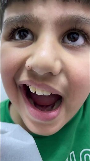 How to pull out a tooth with a tissue #shorts