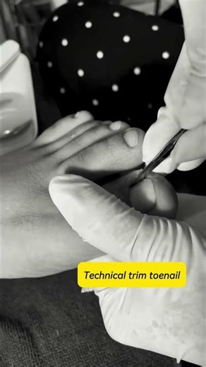Technical is trim toenail #pedicure #toenailcare #trimtoenail #nailar 10