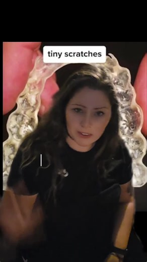 Cleaning Retainers Without Damage: Effective Tips