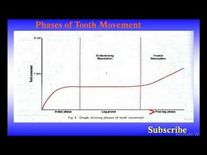 PHASES OF TOOTH MOVEMENT AFTER APPLYING ORTHODONTIC FORCE EXPLAINED: ORTHODONTICS