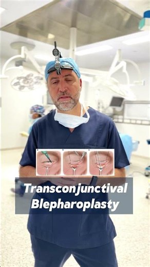 Dr. Chelbi Explains Lower Blepharoplasty Surgery