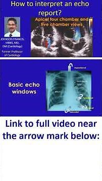 How to interpret an echo report?