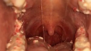 vore | I want to dive in😍 @yb_studio2021 #vore #voregirl #vorefetish #uvula #tonguefetish #tonguethroatlove #tongue #mouth #mouthfetishgirl... | Instagram