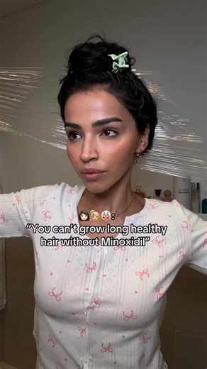 Afsennah | Advanced Trichologist 🔬 on Instagram: "You don’t need Minoxidil to stop excessive hairloss and boost hairgrowth! Take deep oiling with natural DHT blockers seriously and see the results within 3-6 months✨ no side effects and you don’t have to be afraid your hair will fall out when stopping (like what happens with Minoxidil) I’ve been using custom hair growth treatment + microneedle scalp roller and within 6 months my hair transformed! These oils are customized, formulated for your ha