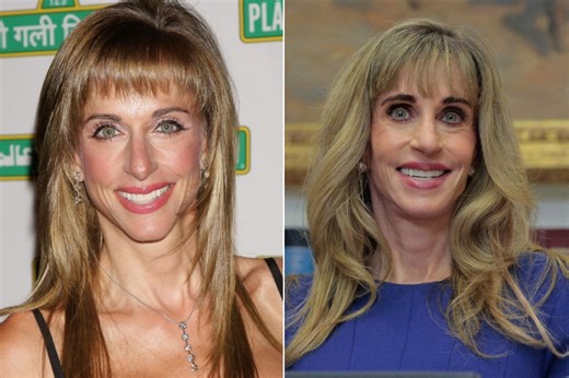 Before & after pics of Susan Dell show 'likely' signs of plastic surgery transformation