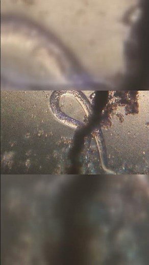 Multiply without permission! Threadworms