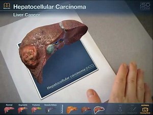 INTERACTIVE - Augmented Reality Liver Viewer: Anatomy App