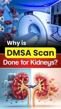 🧪 Why is DMSA Scan Done for Kidneys? ⚠️| Kidney Treatment in USA | #kidney #shorts #kidneydisease
