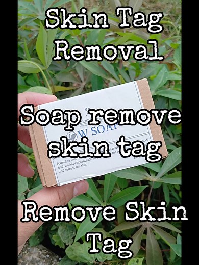 #soap #removeskintag #skintagremover #skintagremoval #fyp