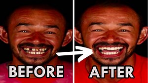 Giving New Teeth To Homeless People