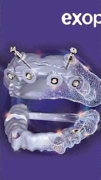 #exoplan #exocad #implantguide # dentalimplant #dentalsoftware