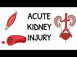 Acute Kidney Injury - Simple and easy to understand