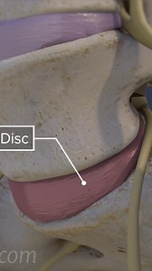 See how a L5-S1 degenerative disc causes pain. | Spine-health