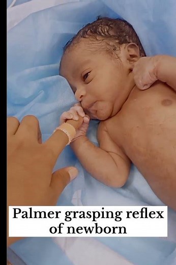 Newborn baby reflex 👶🍼 #medicos #nursingstudents #newborncare