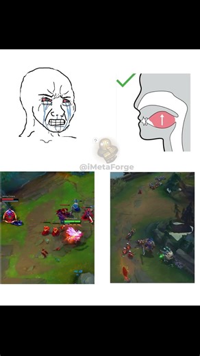 Talent vs Garen 💀