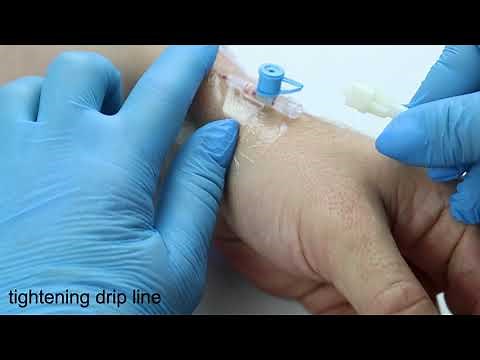 How to start IV drip? Step by step tutorial from nurse