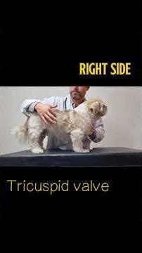 Cardiac auscultation area: where to place the sthetoscope? Mitral, tricuspid, aortic, and pulmonic