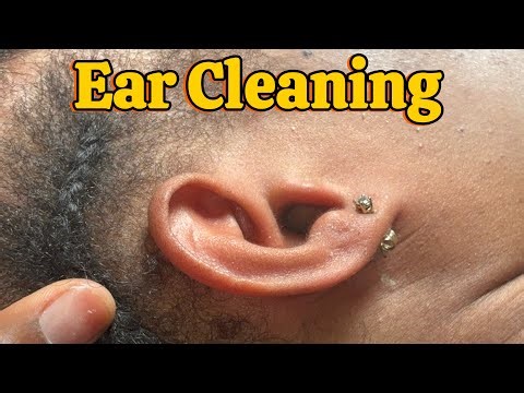 Ear cleaning | ASMR | Gum smacking