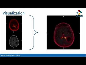 EDISS video series: Medical Image Processing at UIB