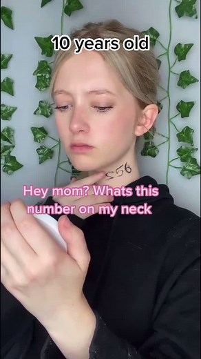 Children Born with Identical Birthmark on Wrist: A Thrilling Story