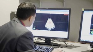 HPV-related oropharynx cancer discoveries - Mayo Clinic