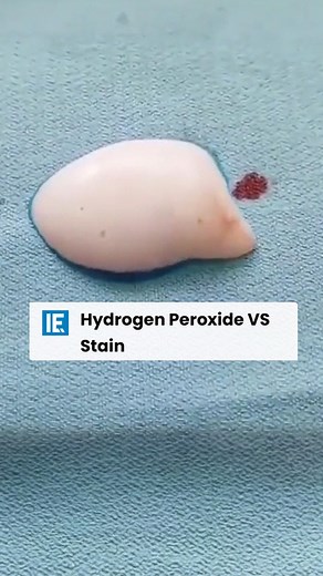 Interesting Engineering on Instagram: "Oxidizing agents in hydrogen peroxide break down the color-causing components of chemical structures and clean stains quickly. #HydrogenPeroxide #CleaningHacks #StainRemoval #OxidizingAgents"