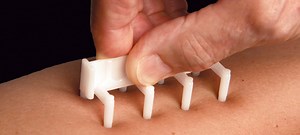 Uncovering Allergy Testing Part 1: What Tests Do I Need?