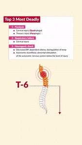 5.8K views · 103 reactions | Spinal Injury Quick Review!✍ | SimpleNursing | Facebook
